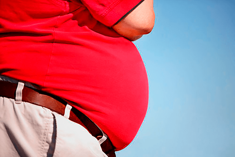 An obese person's belly