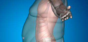 bariatric surgery statistics numbers thumb 1