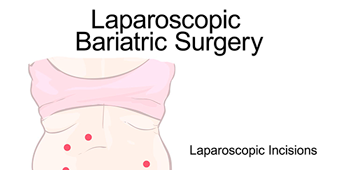 laparoscopic vs open thumb