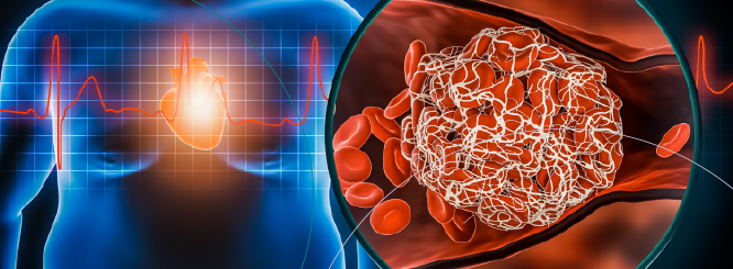 Obesity Risk Factors