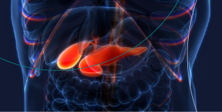 causes of pancreatic cancer2