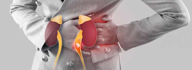 Kidney Stones, Prevention, Management, and Treatment Options