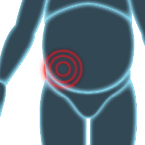 Abdominal Distension in Tijuana Mexico